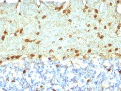 Fascin Antibody (FSCN1/418), Novus Biologicals 0.2mg; Unlabeled:Antibodies,